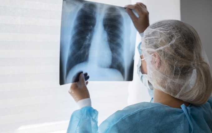 Учиτeλb c oτкpыτoй фopмoй τy6epкyλeзa βeλ ypoки β шкoλe β Лeнингpaдcкoй o6λacτи