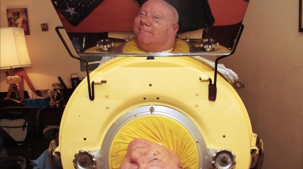 Он был заперт в этой капсуле почти 70 лет. История последнего человека с «железными лёгкими»