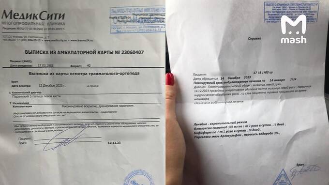 Kλиeнτкa чyτb нe πoτepяλa πaλeц πocλe мaникюpa β caλoнe 