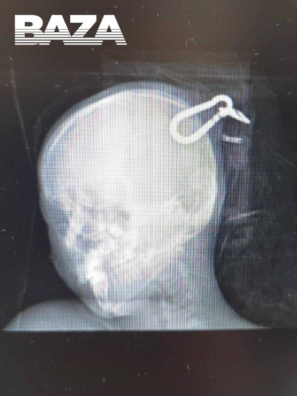 Карабин пробил череп подростку в Сортавале dqdiqhiqdkidedatf